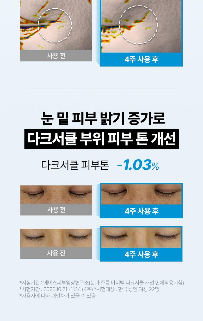 Raepkodeu PDRN Anti-Wrinkle Pack Seon Nunmit Jibangjegeo A Cream Abaek Dakeuseokeul Cream , 3 Pack , 30 ml (랩코드 PDRN 주름개선 눈밑 지방제거 아이크림 아이백 다크서클 크림, 3개, 30ml)