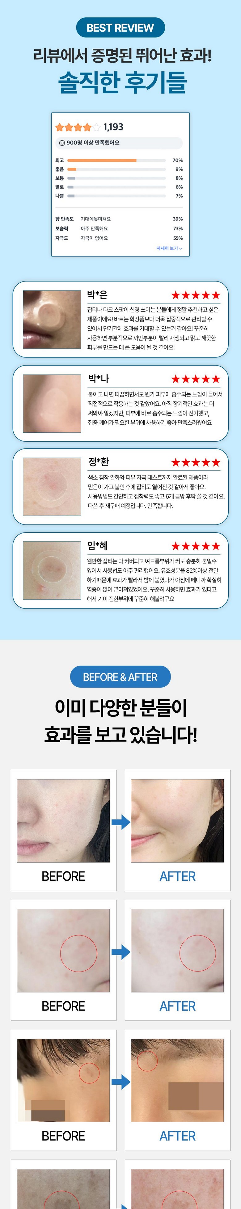 Gimipaechi Geom Mushroom Jugeunkkae Japti Jegeo Makeu Nideul Paechi , 1 Pack , 6 Pack (기미패치 검버섯 주근깨 잡티 제거 마이크로 니들 패치, 1개, 6개입)
