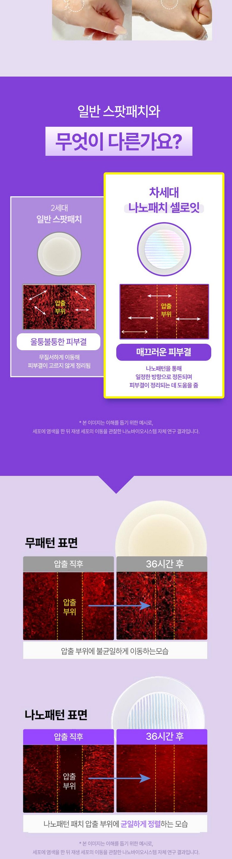Selit Nanopaechi CELLOIT (11 mm) ECM Paechi Spot Paechi Spot Paechi Byuti , 1 Pack , 1 6 Pack (셀로잇 나노패치 CELLOIT (11mm) ECM패치 스팟패치 스팟 패치 뷰티, 1개, 16개입)